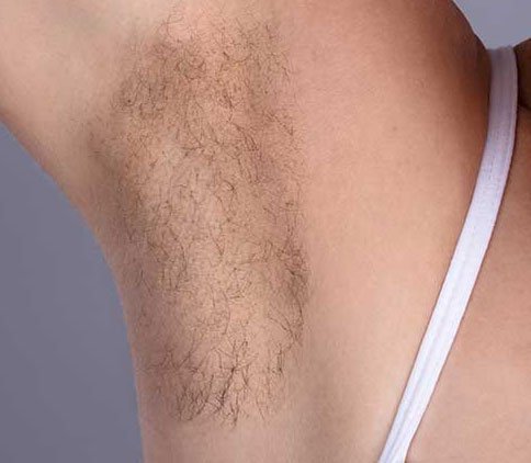Sugaring Hair Removal in Bournemouth Image 1